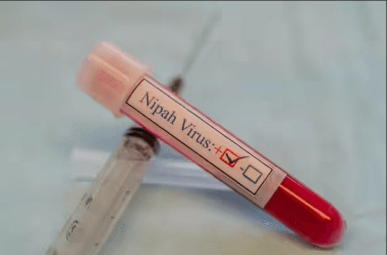 Bengal nurses on ventilator support after showing Nipah virus symptoms
