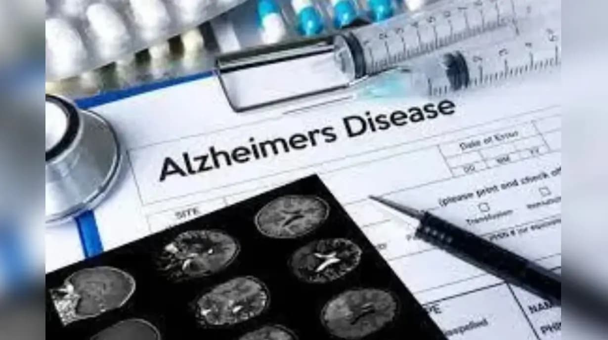 Study describes three distinct trajectories of cognitive decline in Alzheimer’s disease