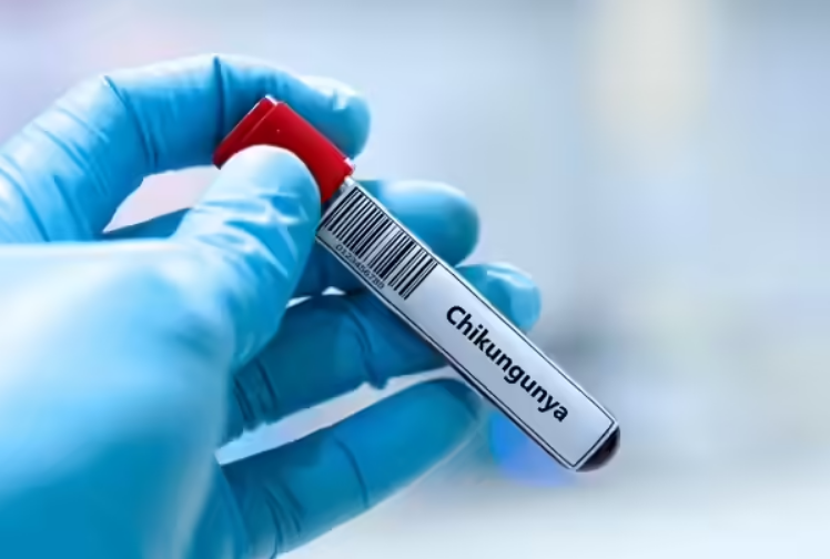 Blood sample test tube labeled Chikungunya virus held by a healthcare professional