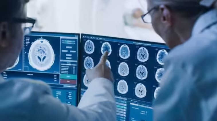 Doctors examining brain scan images on digital screens to study neurological disease patterns