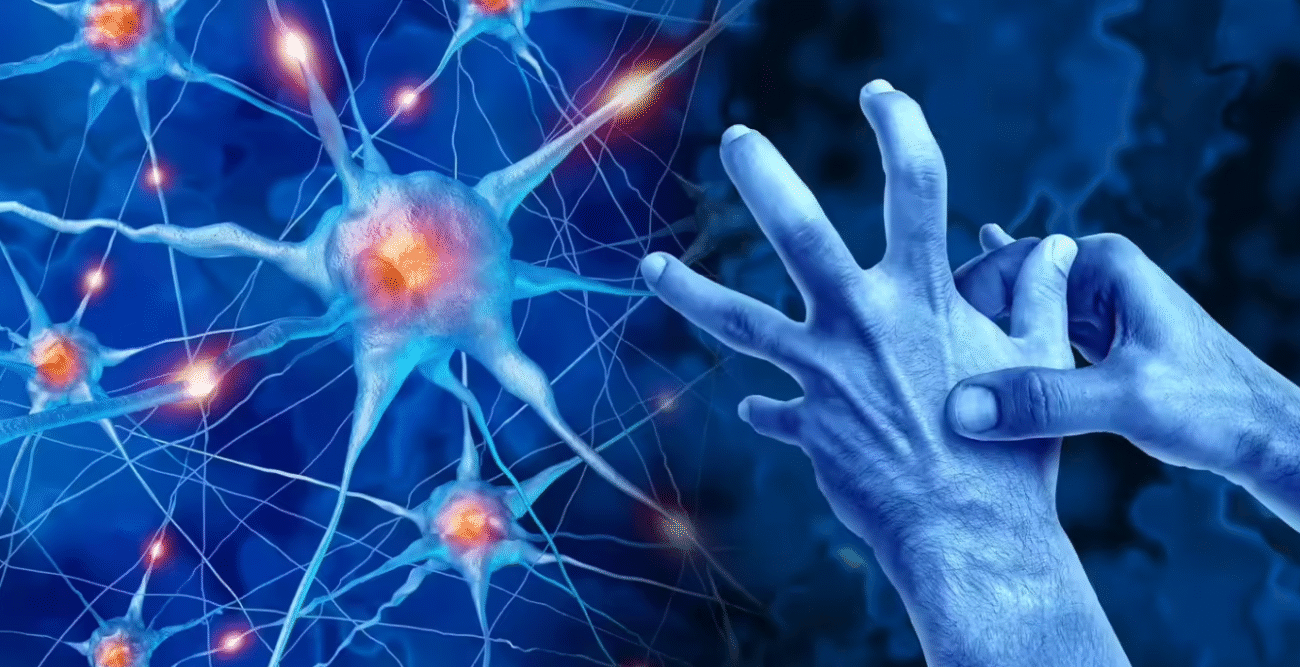 Parkinson’s disease symptoms showing hand tremor with neuron cells illustration in background