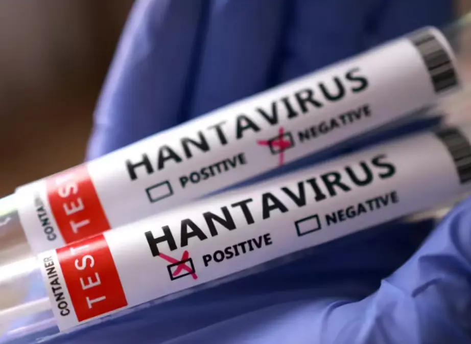 Laboratory test tubes showing positive hantavirus test results during infectious disease outbreak monitoring