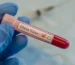 Laboratory technician holding a blood sample tube labeled Ebola virus during infectious disease testing and surveillance